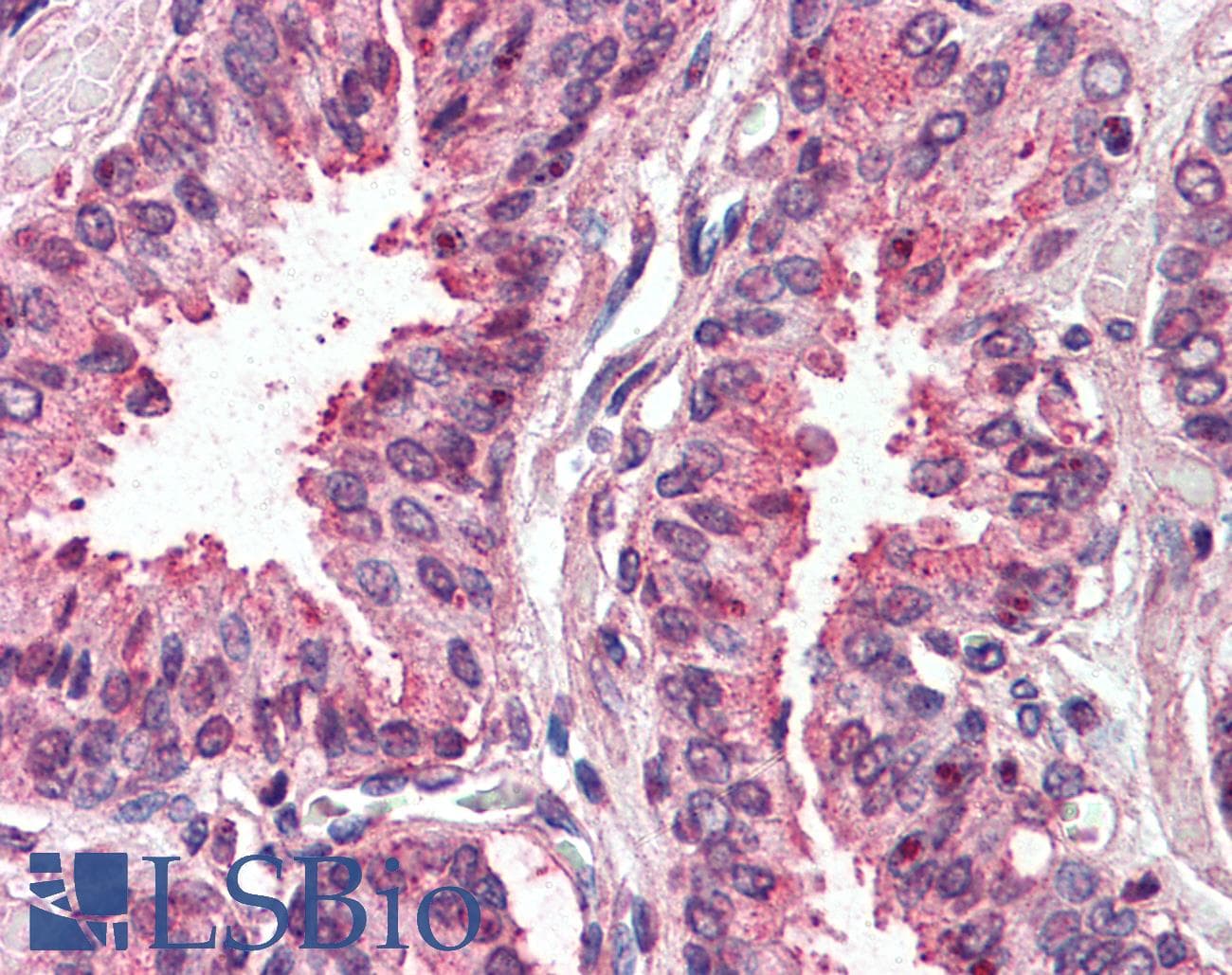 IHC-plus™ TM4SF6 / TSPAN6 Antibody (Internal)