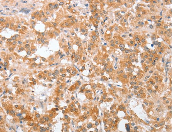 Polyclonal Rabbit anti-Human cPLA2 Antibody (IHC)