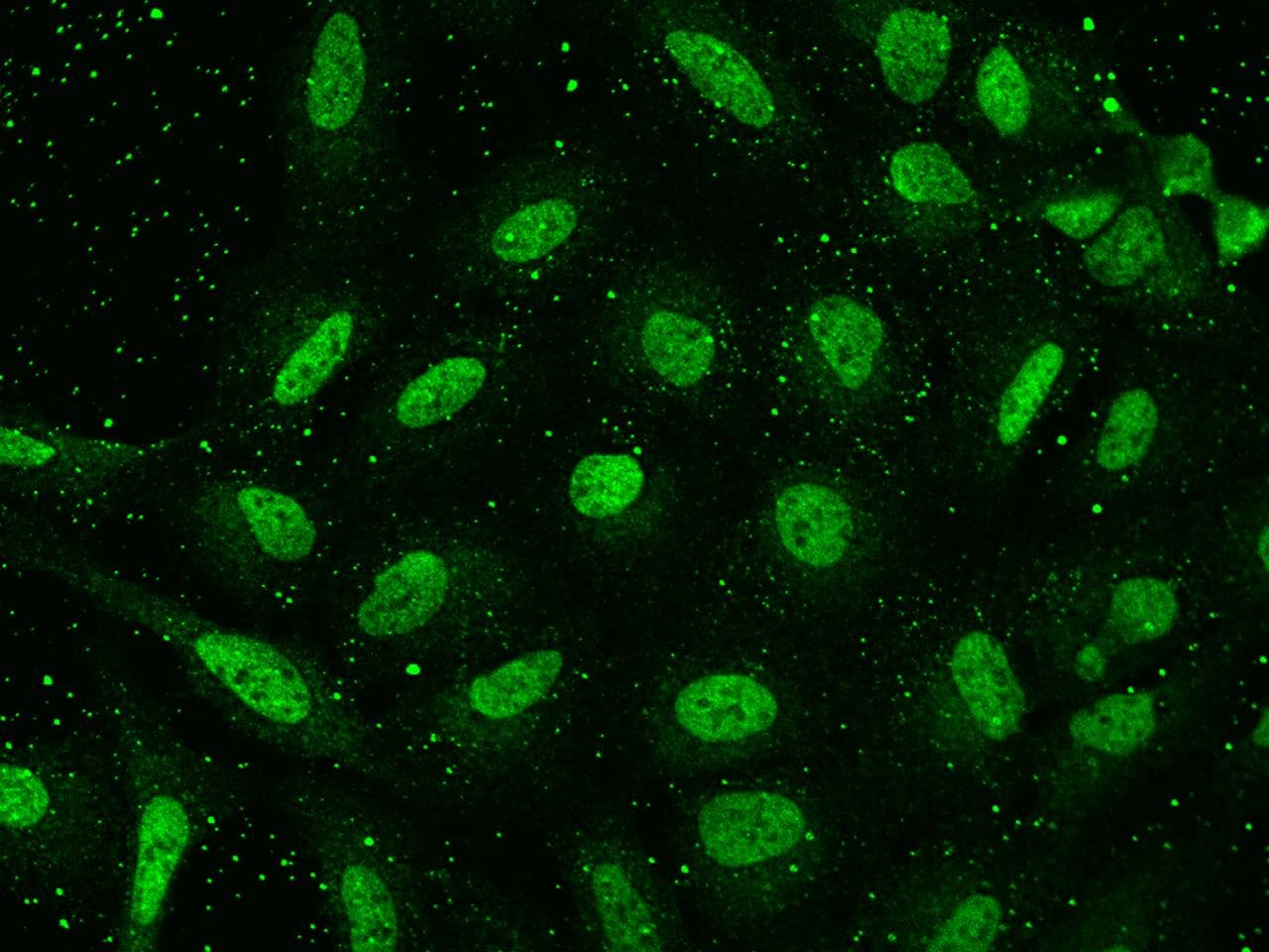 HPD Antibody
