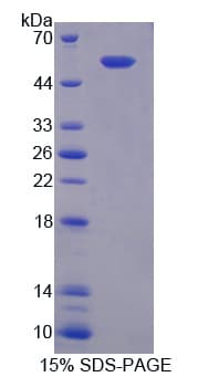 Mouse GJA4 / CX37 / Connexin 37 Protein (Recombinant His-GST)