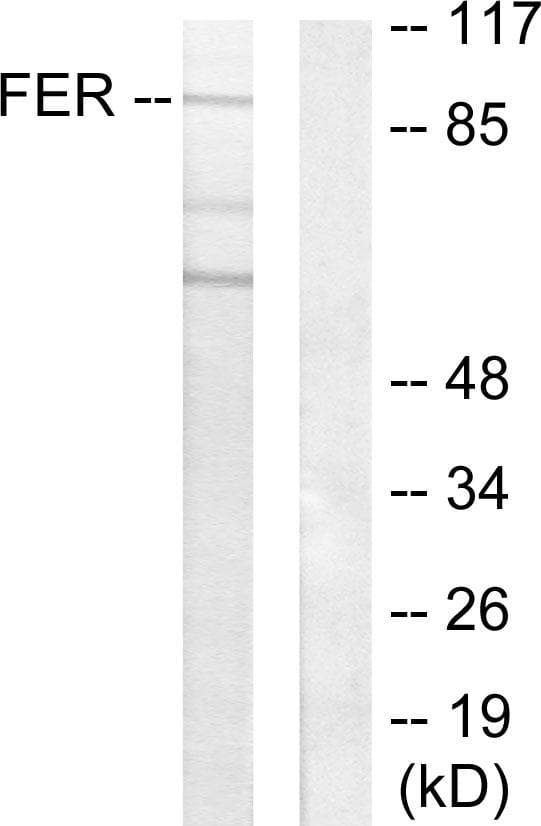 Polyclonal Rabbit anti-Human FER Antibody (WB)
