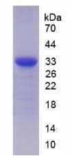 Human ST14 / Matriptase Protein (Recombinant His, N-Terminal)
