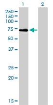 F2 / Prothrombin / Thrombin Antibody (clone 1B7)