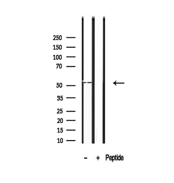 Polyclonal Rabbit anti-Human SHMT / SHMT1 Antibody (IHC, WB)