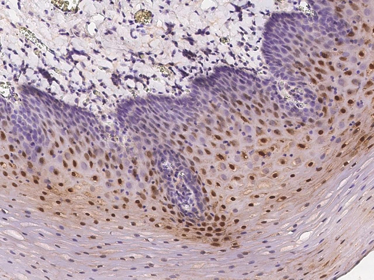 CLIC3 Antibody