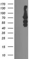 KATNB1 Antibody (clone OTI4C10)