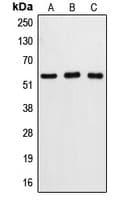 CASP8 / Caspase 8 Antibody (Internal)