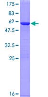 Human CA13 / Carbonic Anhydrase XIII Protein (Recombinant GST)