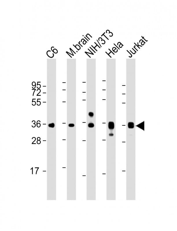 GAPDH Antibody (clone 1653CT401.3.33)