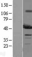 PDIA6 / ERP5 Protein (Over-Expression Lysate Myc-DDK (Flag))