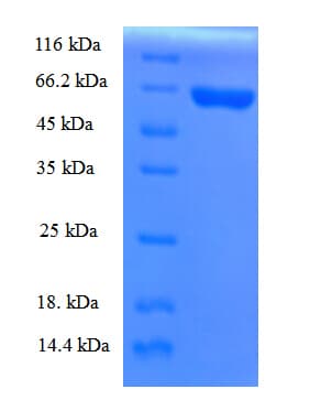 Rat Apolipoprotein A-V (Recombinant GST)