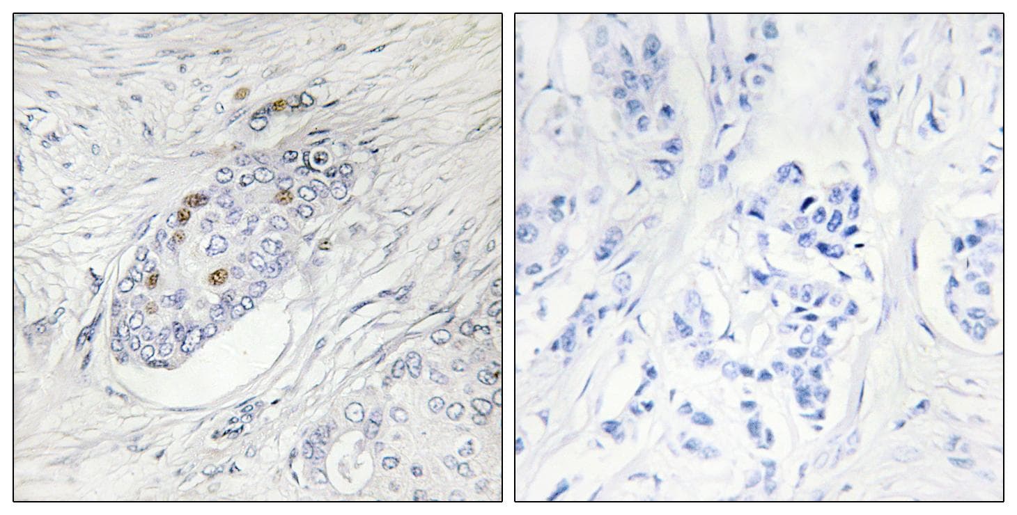 ZNF232 Antibody