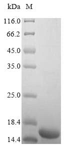 Human IGF1 Protein (Recombinant 6His, N-terminus)