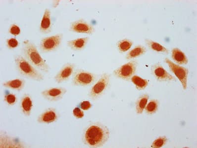 HIST1H2BN Antibody