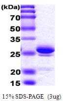 Human HMG1 / HMGB1 Protein (Recombinant His)