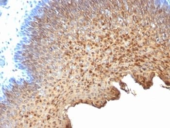 Monoclonal Mouse anti-Human Cytokeratin 10+13 Antibody (clone SPM262, IHC, IF, WB)