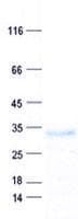 Human DDHD2 Protein (Recombinant His, N-Terminal)
