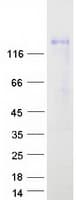 Human SEMA5A / Semaphorin 5A Protein (Recombinant Myc-DDK (Flag))