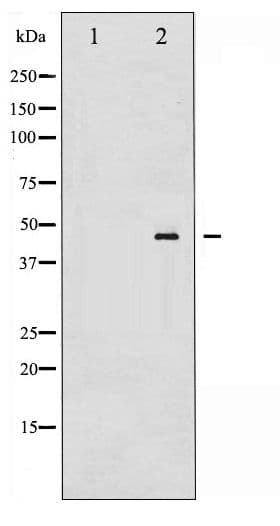 MAP2K4 / MKK4 Antibody (phospho-Thr261)