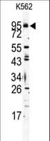 TLR6 Antibody (aa722-753)