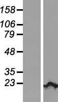 KIAA1143 Protein (Over-Expression Lysate Myc-DDK (Flag))