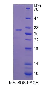 Human TH / Tyrosine Hydroxylase Protein (Recombinant His)