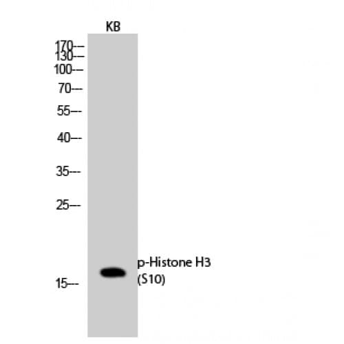 Polyclonal Rabbit anti-Human Histone H3 Antibody (1-80 aa, IHC, IF, WB)
