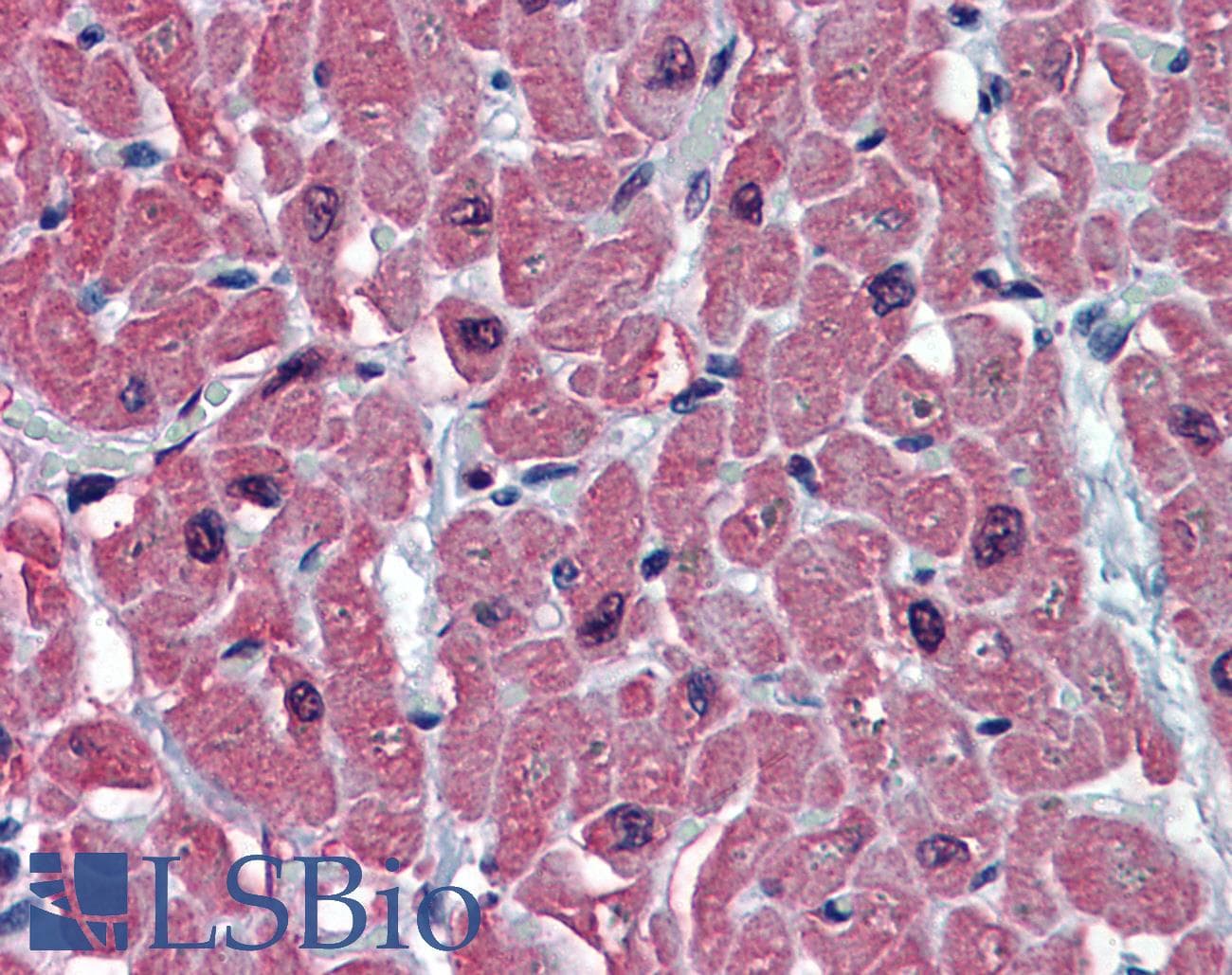 IHC-plus™ TNNC1 / Cardiac Troponin C Antibody (clone 1F8-A9)