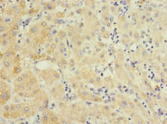 PELI3 / Pellino 3 Antibody