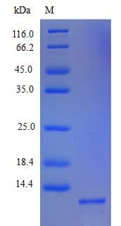 Human CXCL5 Protein (Recombinant)