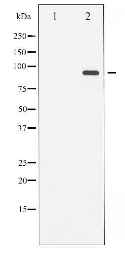 PR / Progesterone Receptor Antibody (phospho-Ser400)
