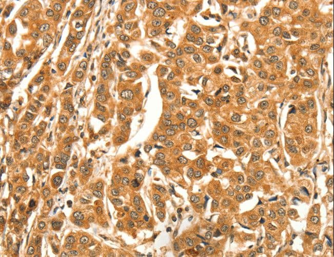 Polyclonal Rabbit anti-Human GBTS1 / DIRAS1 Antibody (IHC)