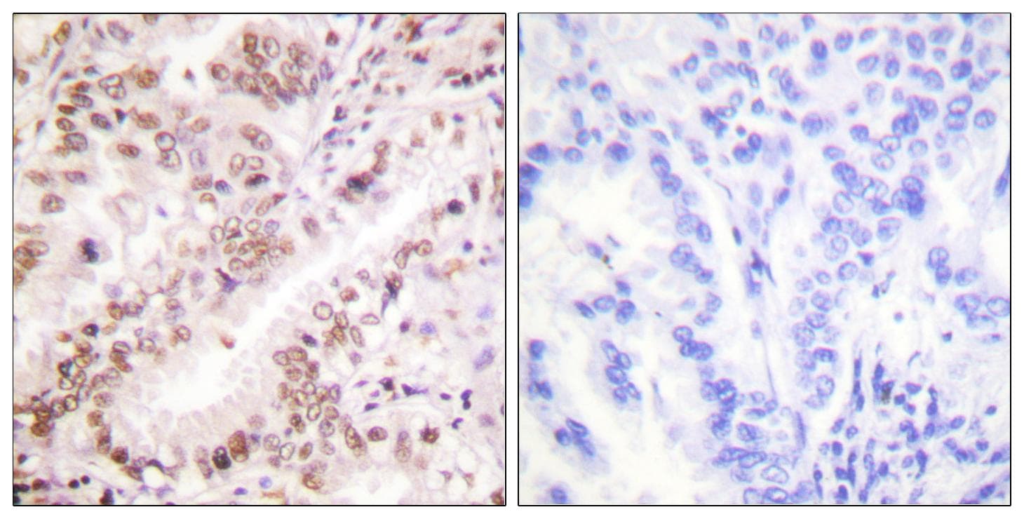 ER Alpha / Estrogen Receptor Antibody (phospho-Tyr537)