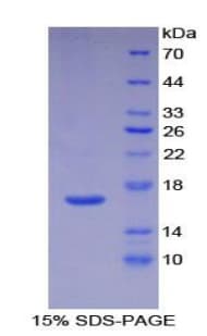 Human IL16 Protein (Recombinant His-T7)