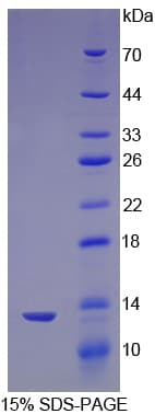 Mouse NPHS1 / Nephrin Protein (Recombinant His)