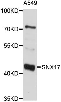 Polyclonal Rabbit anti-Human SNX17 Antibody (WB)