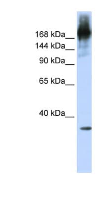 PRPF8 Antibody (aa360-409)