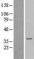TCEAL6 Protein (Over-Expression Lysate Myc-DDK (Flag))