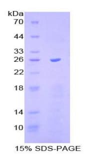Mouse SCAF11 / SFRS2IP Protein (Recombinant His-T7)