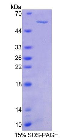 Mouse PTK2B / PYK2 Protein (Recombinant His-GST)