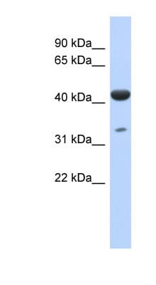 Polyclonal Rabbit anti-Human ISPD / Nip Antibody (N-Terminus, WB)