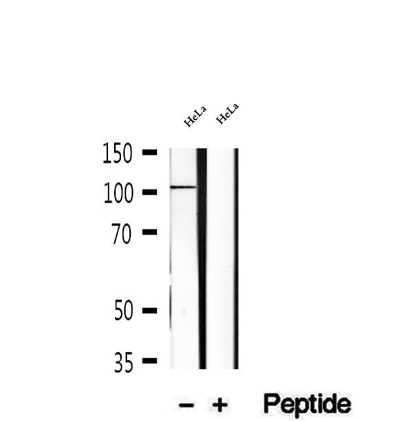 KIF18A Antibody (aa228-252)
