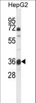 MOSC1 Antibody (aa175-204)
