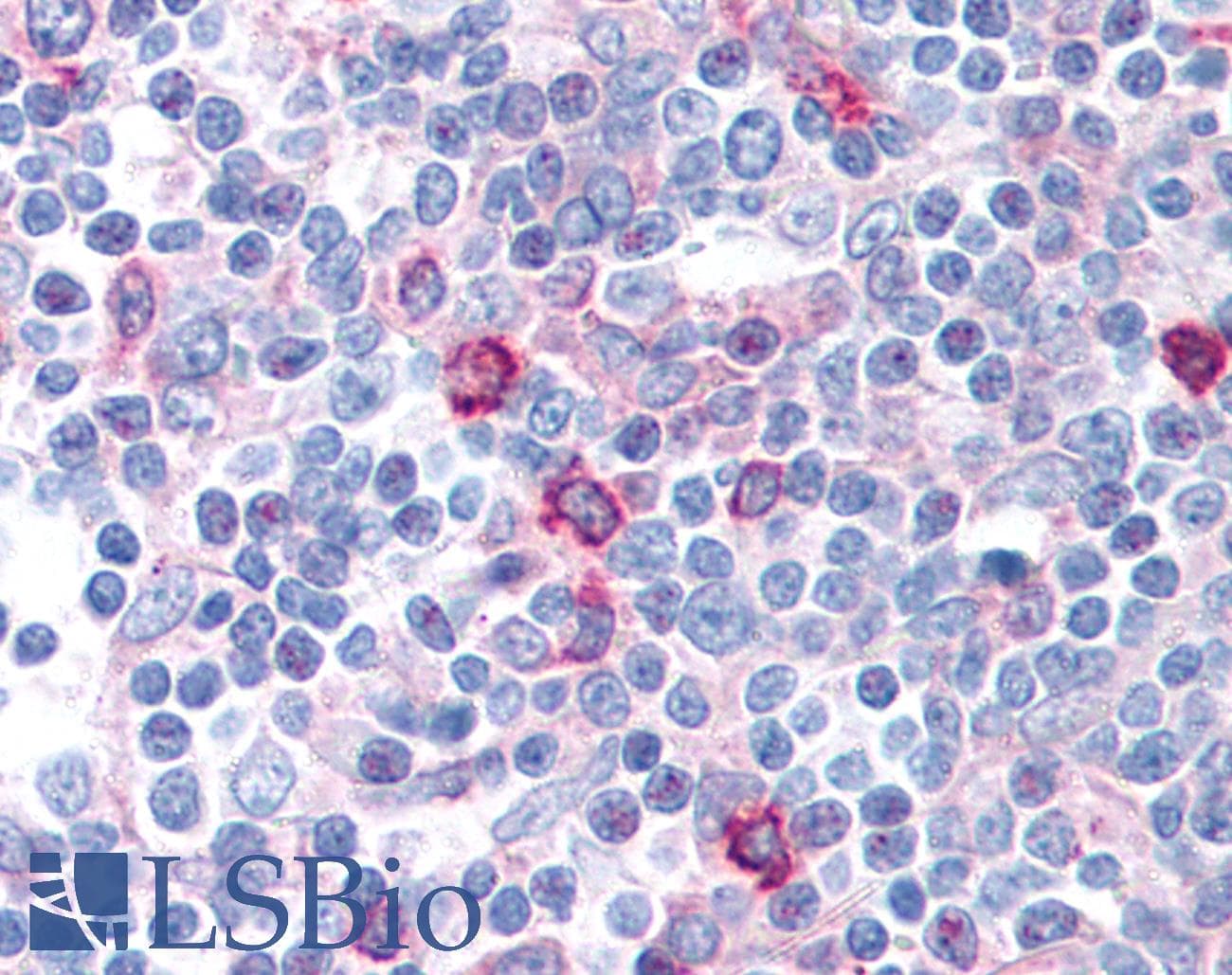 IHC-plus™ Polyclonal Rabbit anti-Human STAT2 Antibody (C-Terminus, IHC, WB)