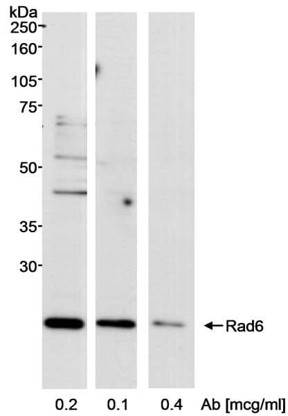 Polyclonal Rabbit anti-Human UBE2A Antibody (aa100-150, WB)