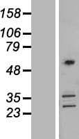 CORO2B Protein (Over-Expression Lysate Myc-DDK (Flag))