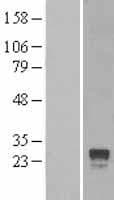 Human RGS4 Protein (Over-Expression Lysate Myc-DDK (Flag))