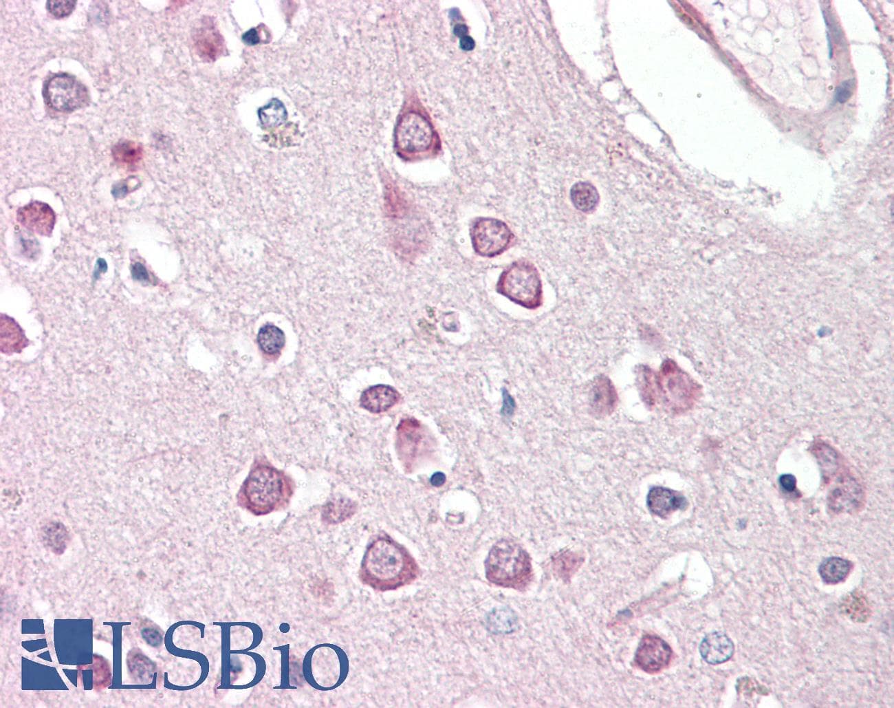 IHC-plus™ Polyclonal Goat anti-Human HAP1 Antibody (aa469-480, IHC, WB)