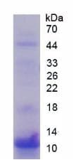 Human S100P Protein (Recombinant His, N-Terminal)