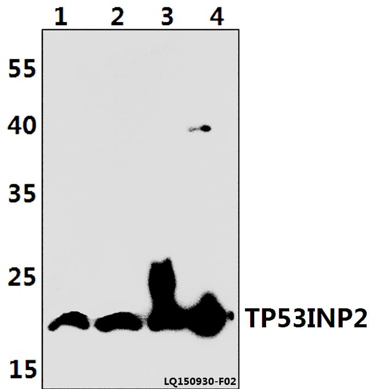 Polyclonal Rabbit anti-Human TP53INP2 Antibody (WB)